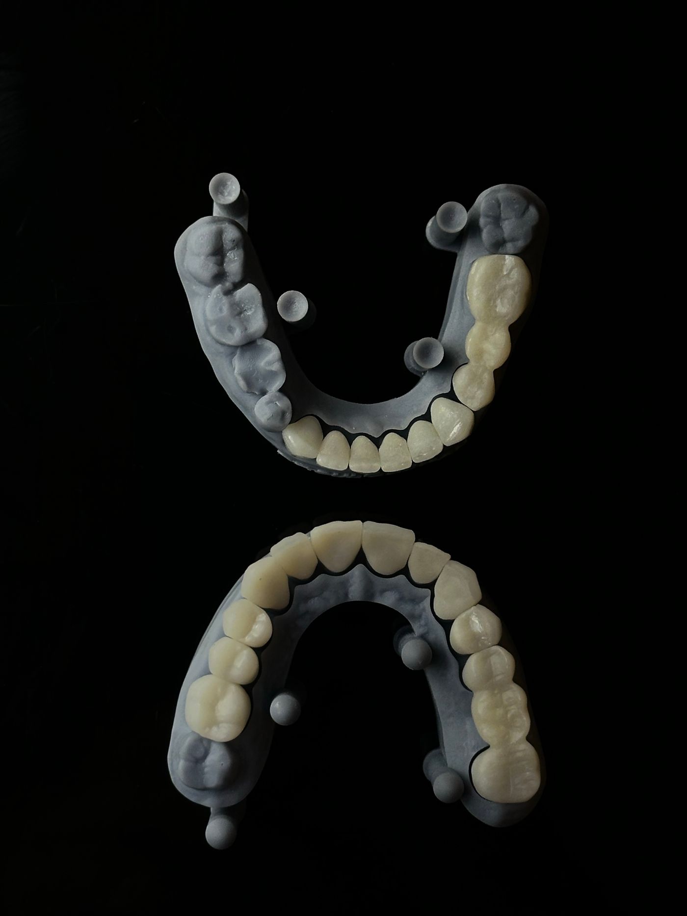 Zwei im 3D-Druck gefertigte Kiefermodelle vor schwarzem Hintergrund
